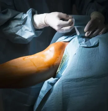 best Arthroscopy hospital in ravet